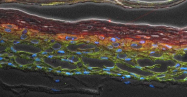 Keratinocyte Differentiation in Organotype Models