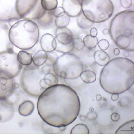 Pancreatic organoids have robust predictive power and can be used to test the impacts of potential treatments on patients - Image courtesy of Dr. Hervé Tiriac, University of California, San Diego