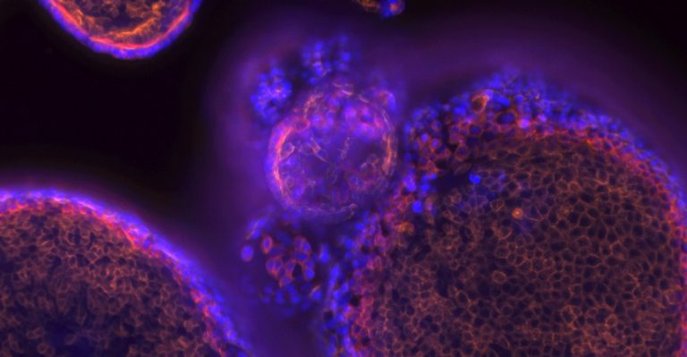 pancreatic organoids