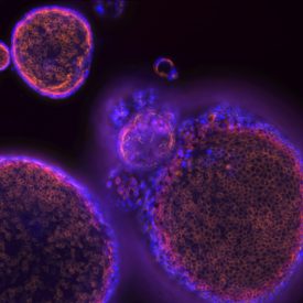 pancreatic organoid