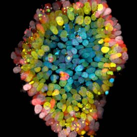 Organoid image