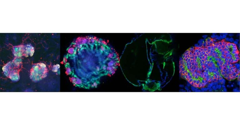 Kidney Organoids