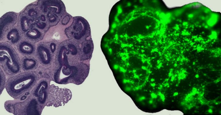 Choosing the Best 3D Cell Culture Model for Your Research Infographic