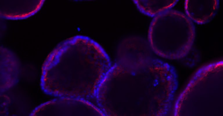 Spheroids and organoids