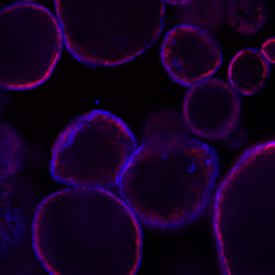 Spheroids and Organoids